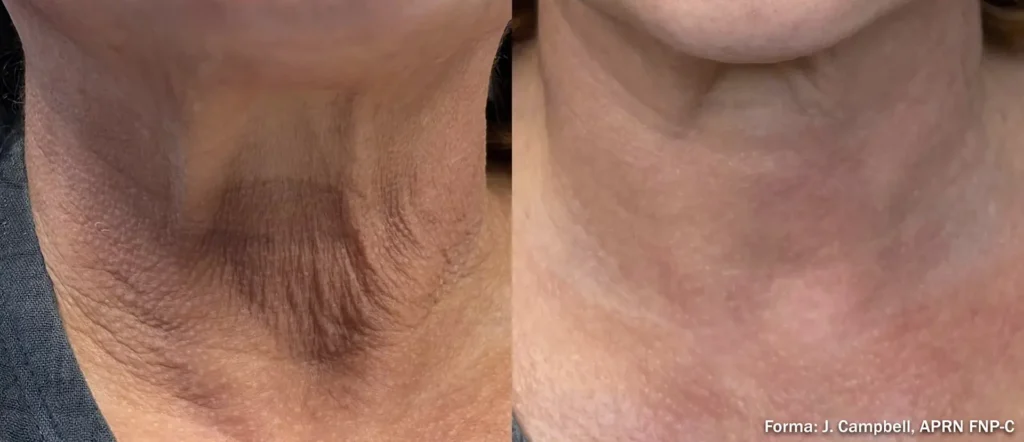 JC_Forma_Neck-TM
